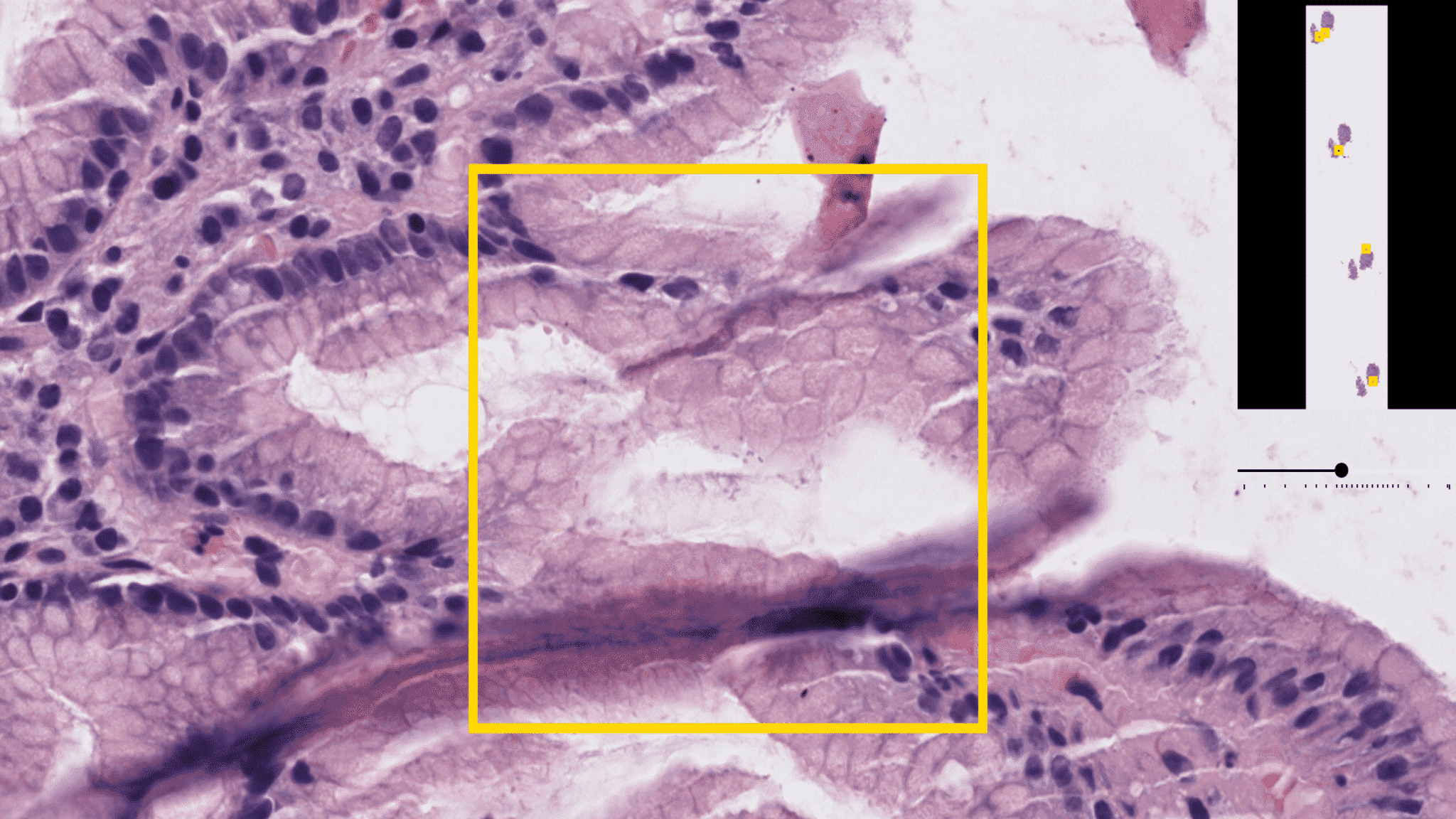 This Israeli Startup Is Using AI To Revolutionize Pathology