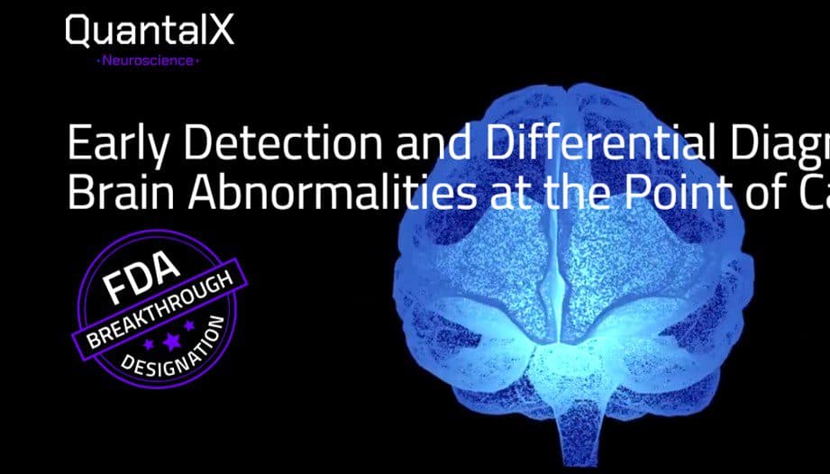 QuantalX's Neurodiagnostic Device Earns FDA Breakthrough Designation