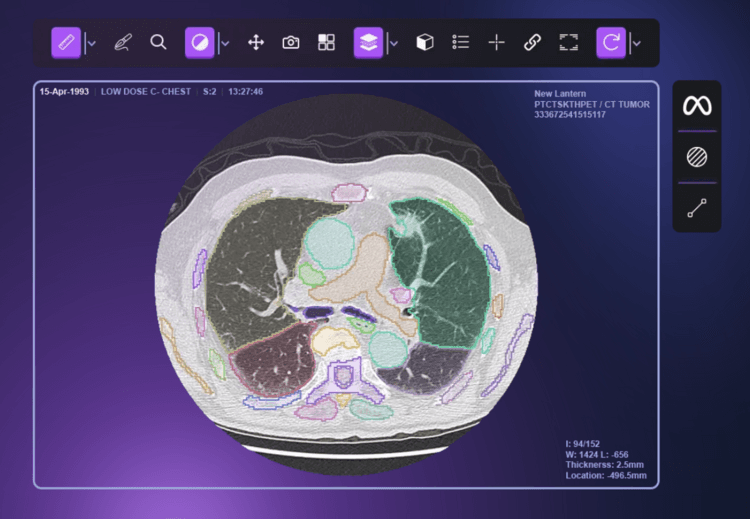 New Lantern Emerges From Stealth with AI Radiology Resident and $19M Funding