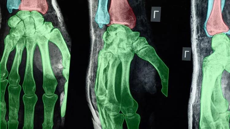 Bridging Medicine and AI: How Data Annotation is Revolutionizing the Future of Healthcare