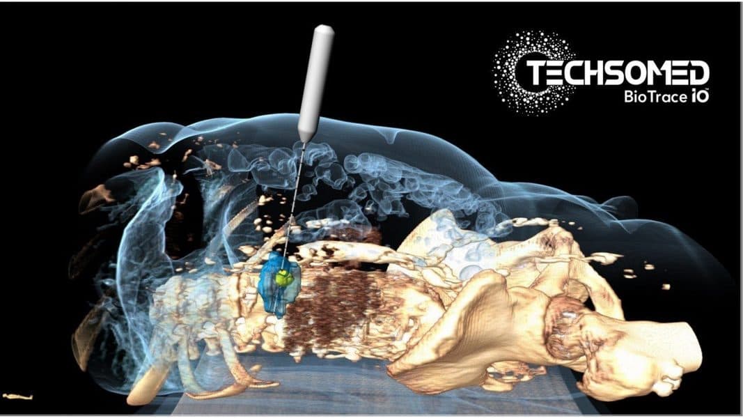 Medical imaging startup TechsoMed Raises $7 Million Series B