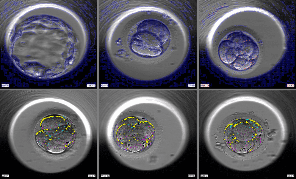 This Israeli Startup is Using Deep Learning and Computer Vision to Revolutionize IVF Treatments