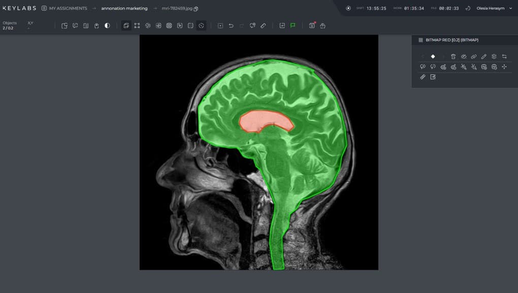 keymakr image annotation